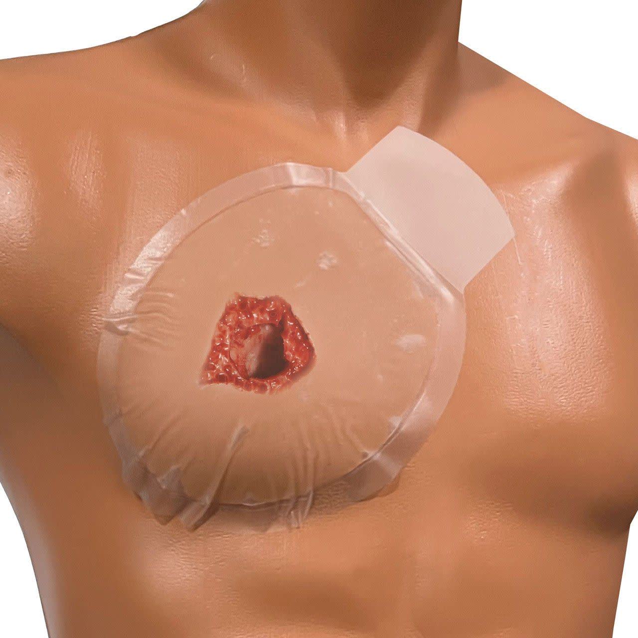 Chest Seals